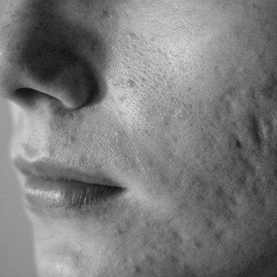 Re:Skin™